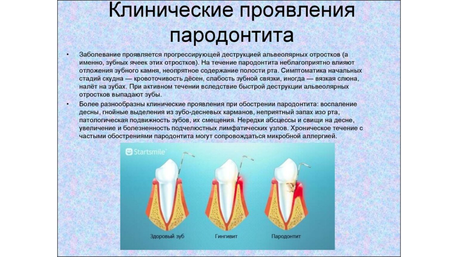 Признаки лечения зубов. Пародонтит локализованный классификация. Гингивит пародонтит классификация. Клинические проявления пародонтита. Клинические проявления заболеваний пародонта.