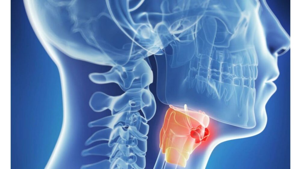 Ркб им вишневского. Центральная республиканская поликлиника в махачкале. Гематологическое отделение республиканской больницы. Ркб им вишневского. Центральная больница в махачкале фото.