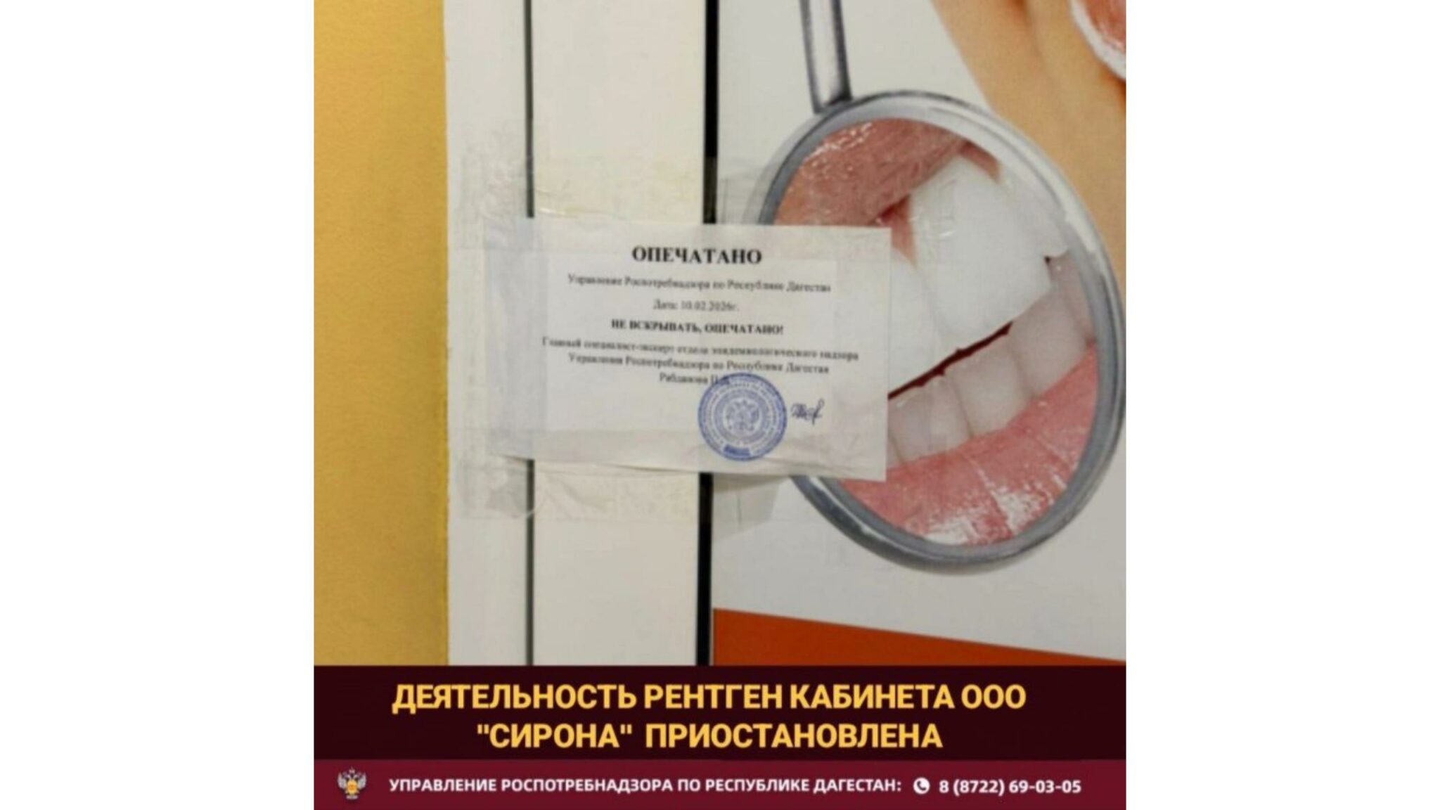 В Дагестане рентген-кабинет клиники «Сирона» опечатали из-за нарушений